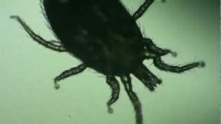 Dermatology Dermatophagoides pteronyssinus House Dust Mite [upl. by Horne]