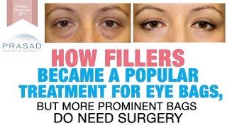 Treating Puffy Eye Bags  How Fillers Became Popular and Why Surgery is Best for Prominent Bags [upl. by Nahc]