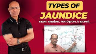 Types Of Jaundice  Causes Symptoms amp Treatment  Dr Najeeb [upl. by Ainak]