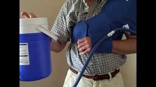 Aircast Shoulder Cryo Cuff Video Review  DMEDirectcom [upl. by Olathe90]