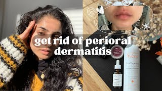 my perioral dermatitis journey  what actually worked what didnt natural healing and more [upl. by Roosevelt667]