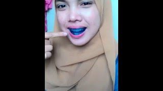 CARA PAKAI TEETH TRAINER ALIGNMENT dari WAWAZULMAHDI [upl. by Rundgren]