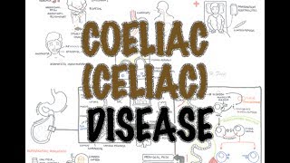 Coeliac Celiac Disease  Overview signs and symptoms pathophysiology diagnosis treatment [upl. by Islean]