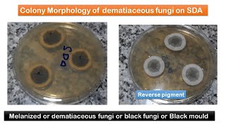 Melanized Fungal growth on SDA and list of black fungi [upl. by Sucy153]