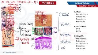 Dermatología  Psoriasis [upl. by Nonnahs855]