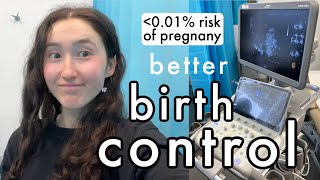 The birth control method no one talks about  Everything you need to know about the Gynefix [upl. by Sang98]