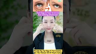 Eye Bags amp Tear Grooves Are Getting Shallower eyelift eyeexercise yoga faceyoga facialyoga fit [upl. by Ardnac132]