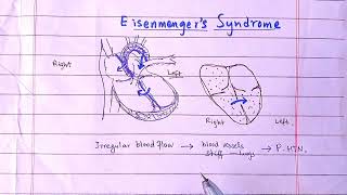 Eisenmenger syndrome  What will Happen If Blood Flows From Right to Left Heart [upl. by Snah]