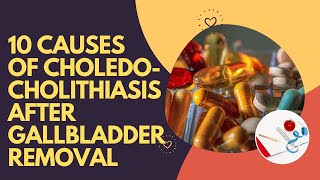 10 Causes Of Choledocholithiasis After Gallbladder Removal [upl. by Tani]