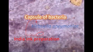 India ink preparation showing capsule of bacteria [upl. by Bourke197]