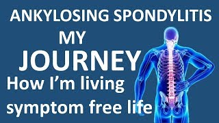 HINDIहिन्दी Ankylosing Spondylitis Journey  How Im living symptom free life  HLAB27 [upl. by Oberg320]