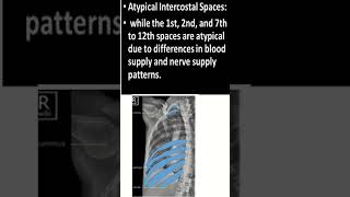 How to identify intercostal spaces in Chest X ray shorts chestradiograph [upl. by Babs]