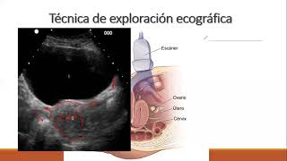 ULTRASONIDO PELVICO MEDIDAS ANATOMIA TECNICAS [upl. by Analat]