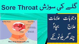 Sore Throat  Causes Symptoms Treatment Prevention and Cautions  Urdu  Hindi  Shahbaz Qamar [upl. by Goldin794]