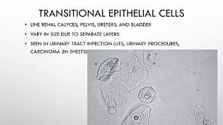 Chapter 7 Microscopic Examination of Urine [upl. by Alejo3]