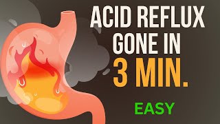 How to Get Rid of Acid Reflux PERMANENTLY with Betaine hydrochloride  Treat Acid Reflux Naturally [upl. by Onihc]