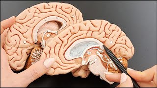 Brain Anatomy Cross Section Structures  MADE EASY  Part 3 of 5 [upl. by Dimphia]