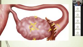 Histologia do genital feminino [upl. by Rica]