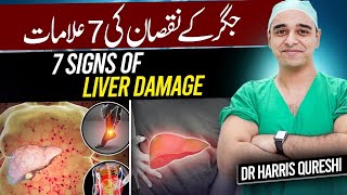 7 Signs Of Liver Damage  جگر کے نقصان کی 7 علامات  लिवर खराब होने के 7 लक्षण  DrHarris Qureshi [upl. by Matthaus]