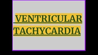 VENTRICULAR TACHYCARDIA [upl. by Doggett]