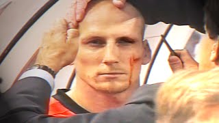 Jaap Stam eyebrow injury  EURO 2000 Netherlands v Czech Republic [upl. by Okin]