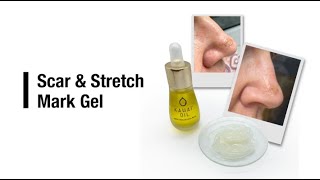 Scar amp Stretch Mark Gel [upl. by Simonsen]