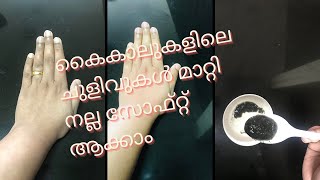 കൈയിലെ ചുളിവുകൾ മാറ്റി Soft ആകാം  How To Remove Wrinkles From Hands And Legs Naturally Malayalam [upl. by Merry]