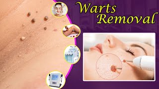 Free Beautician course Warts removal in Telugu [upl. by Arikahc815]