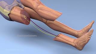 rotationplasty femur breaker [upl. by Sdlonyer]