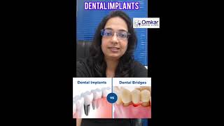 Dental Implants  Dental implants vs dental bridges [upl. by Sualocin]