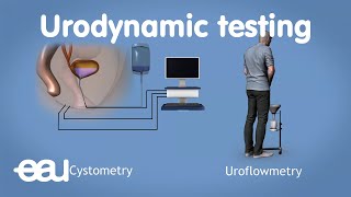 Urodynamics for overactive bladder [upl. by Aehsrop75]