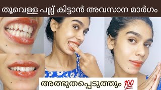 Shihana Shas ന്റെ teeth whitening powderറിസൾട്ട്‌ കിട്ടാത്തവർക്ക് വീട്ടിൽ കേറി വന്ന് അടിക്കാം😯 [upl. by Ardnwahs641]