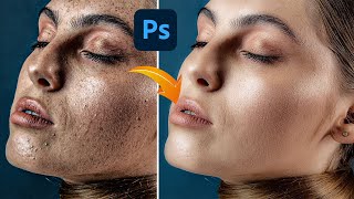 High  End Skin Retouching Photoshop Tutorial [upl. by Tarra]