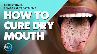 Xerostomia Dry Mouth Remedy amp Treatment To Cure The Symptoms And Causes Of Xerostomia [upl. by Goldner]