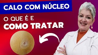 CALO COM NÚCLEO O Que É e Como Tratar [upl. by Rennat]