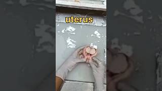 Uterus specimen grossing 🧐👀 [upl. by Alledi858]