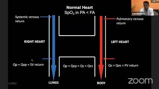 Webinar 1 cyanotic congenital heart disease [upl. by Nikita]