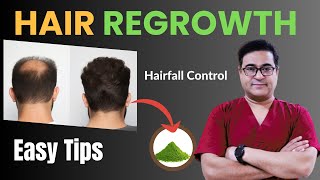 Guaranteed Hair Regrowth Tips by Dr Vikram  hairregrowth hairfall [upl. by Kare]