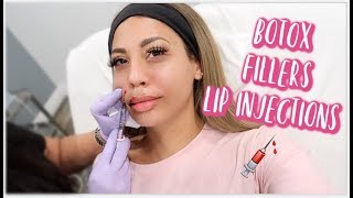 ENTIRE FACE OF BOTOX FILLER amp LIP INJECTIONS [upl. by Schramke]