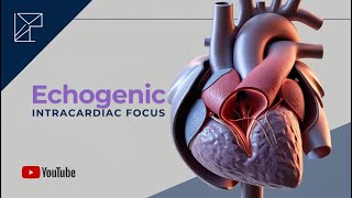 The Genetic Sonogram Echogenic Intracardiac Focus [upl. by Eisdnyl]