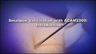 Chapter 1 Smallpox Vaccination with ACAM2000 Introduction [upl. by Mungovan]