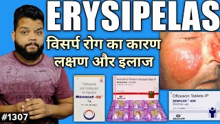 विसर्प रोग लक्षणकारण और इलाज  Erysipelas CauseSymptoms amp Treatment In Hindi [upl. by Iel326]