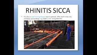 ENT Rhinitis Sicca Dry Nose Occupational [upl. by Frankie]