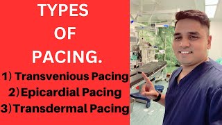 Types Of Pacing Transvenious PacingEpicardial PacingTransdermal Pacing [upl. by Dinin]