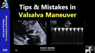 Tips amp Mistakes in Valsalva Maneuver [upl. by Clevie]