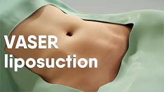 VASER liposuction is also called ultrasoundassisted liposuction VASER lipo or LipoSculpting [upl. by Tabor689]