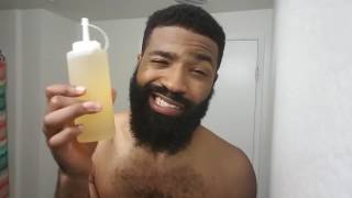 A Quick and Easy Way To Prevent Ingrown Hairs Under Your Beard Apple Cider Vinegar🔥🔥🔥 [upl. by Duleba582]