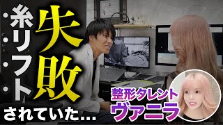 【密着】整形総額３億円タレントのヴァニラが糸リフトで失敗修正手術を担当しました【糸リフトの修正手術】 [upl. by Calie]