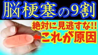 絶対に見逃してはいけない動脈硬化が進むと現れる危険な脳梗塞の要注意サイン‼脳卒中を90予防し業務スーパーで買える血管ツルツルにする最強の朝ご飯と寝る前リンパマッサージで動脈硬化を予防する方法 [upl. by Eltsyek]