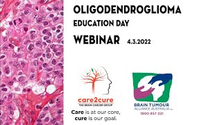 OLIGODENDROGLIOMA Education Day WEBINAR [upl. by Behlke]